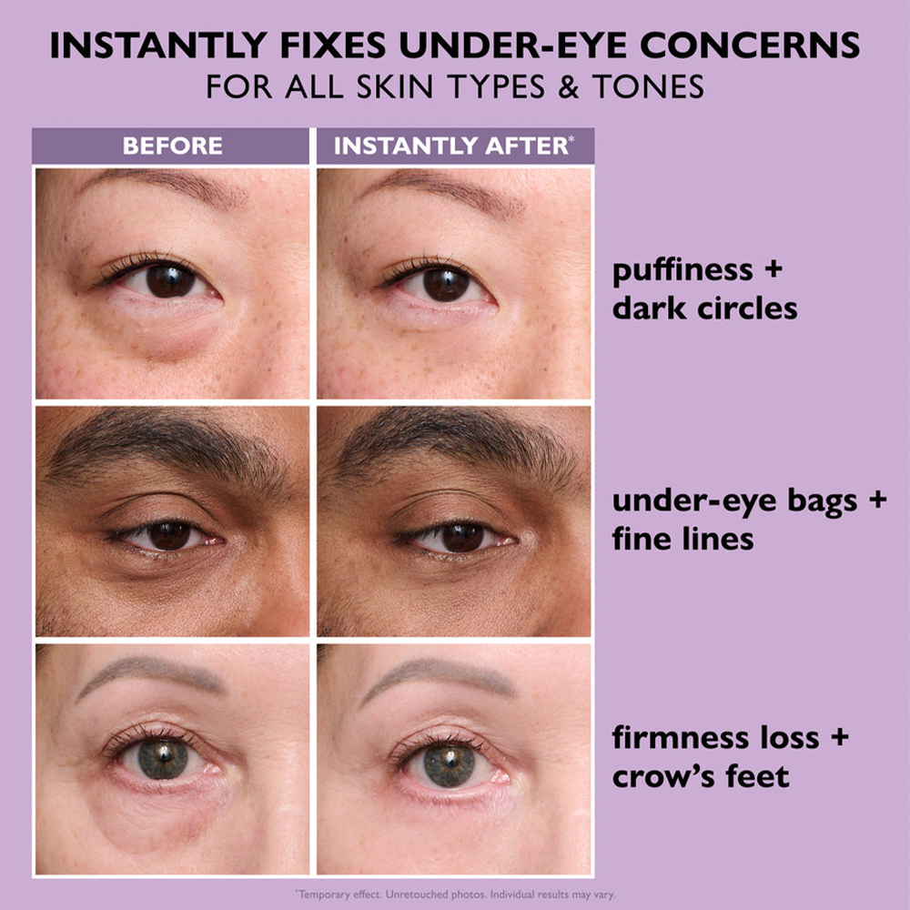 💕 Perfection Eye Lift – New Formula, Ultimate Lift & Smooth